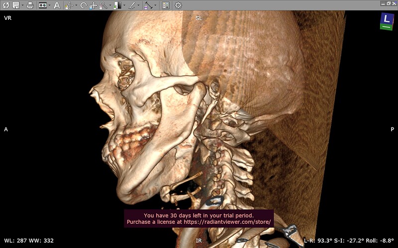radiant-left3d