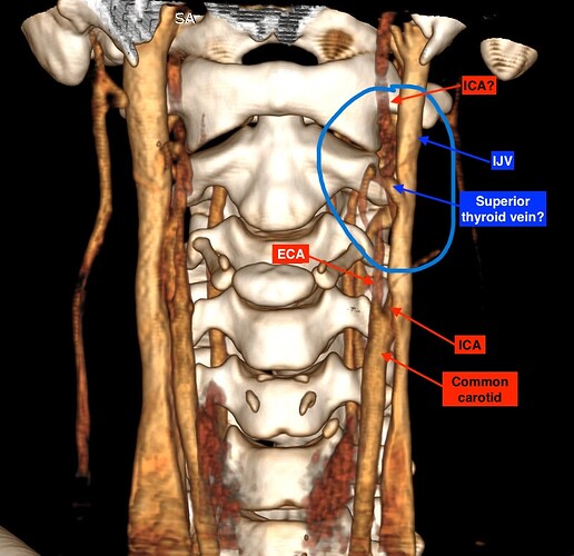 Screenshot 2025-11-15 231921