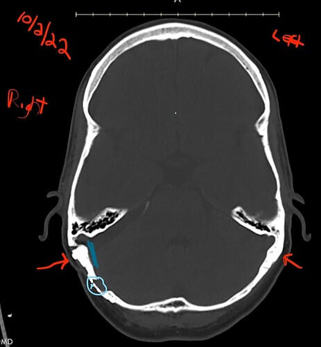 InkedInkedScreen Shot 2022-10-14 at 1.06.09 PM_LI