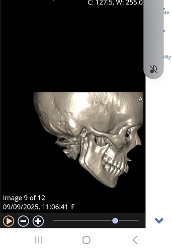 Screenshot_20250912_162558_Chrome