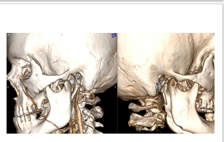 Screenshot_20251107-095446~2