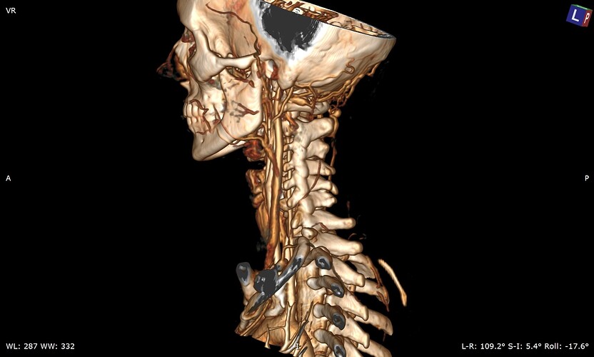 Pic 7 Left Side Angle