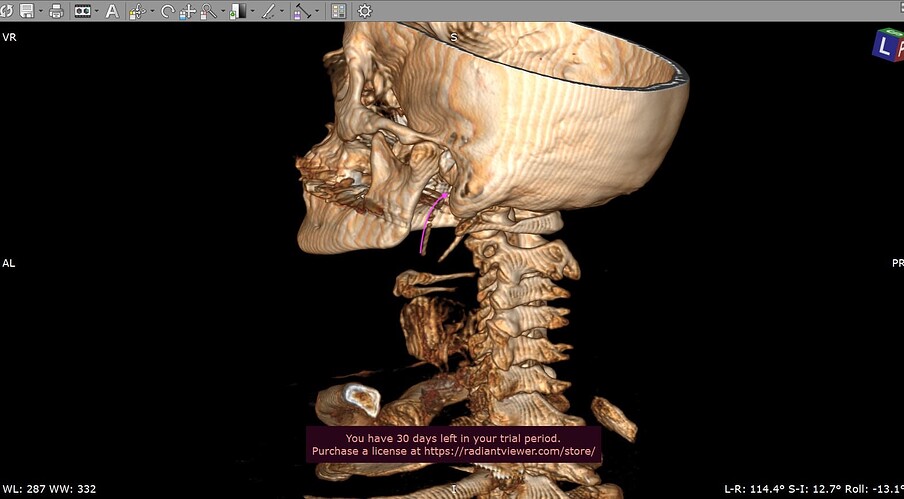 image-14