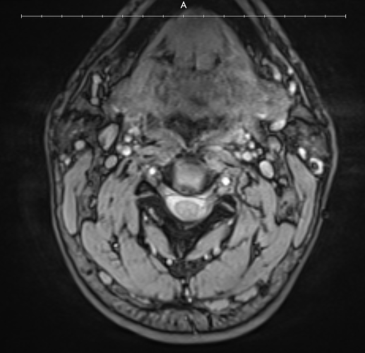 MRI 1