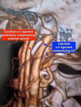 PXL_20250828_185637646.MP