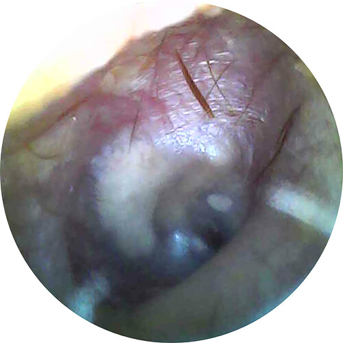 rtsp_snapshot_true_101_1764645285423