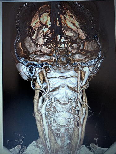 PXL_20251105_192841409