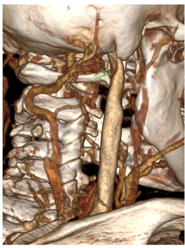 Screenshot_20251107-095318~2