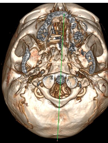 Screenshot_20251107-095426~2