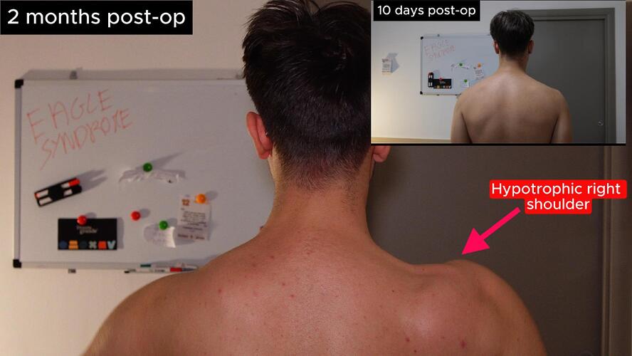 Update surgery-Copertina