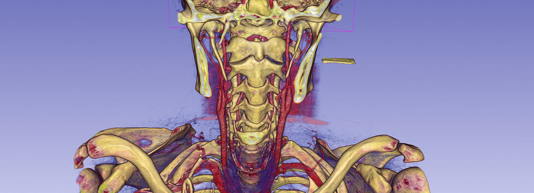 anterior-neck-cutout