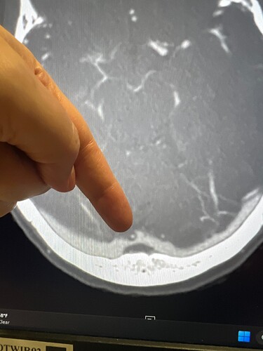 78356765517__7C398536-2E0D-47C6-BB62-34E3201F45FF