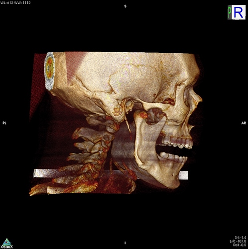 3D%20VR%20Image1
