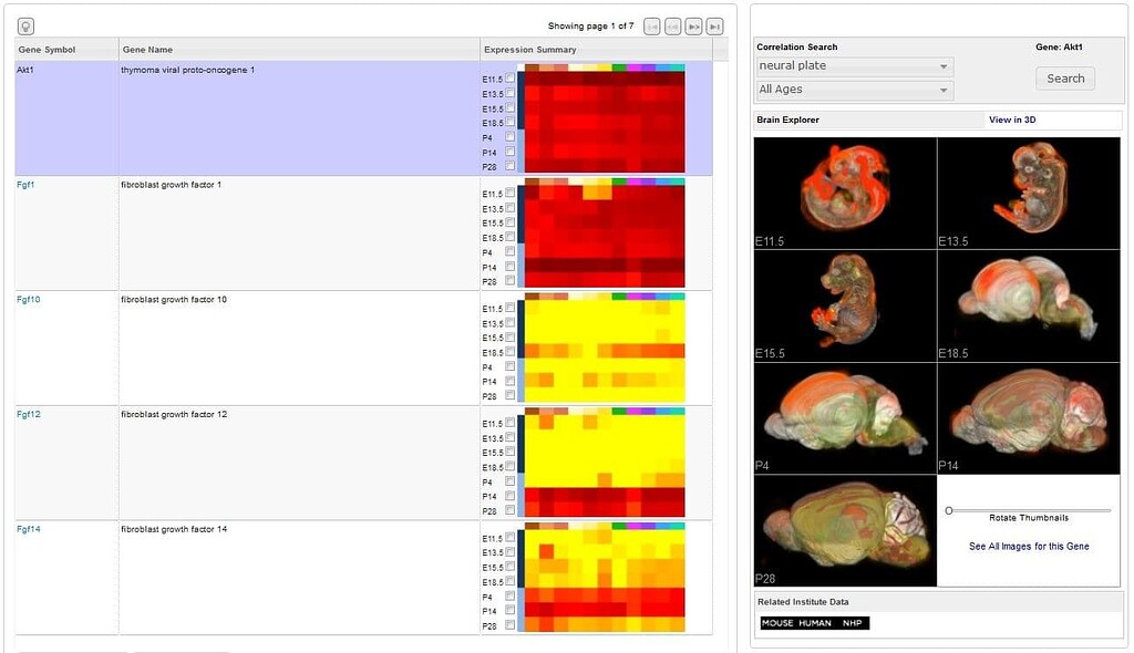 brainページ dcdacf920005c41dafacda1158f872