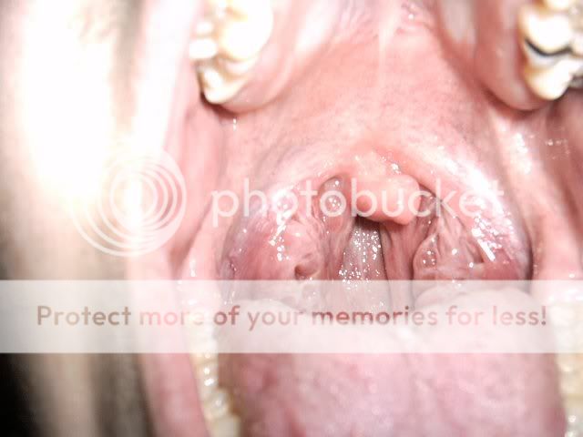 http://img.photobucket.com/albums/v187/shalerpunk/puke.jpg
