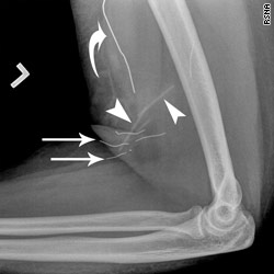 http://i2.cdn.turner.com/cnn/2010/images/09/03/t1main.xray.rsna.jpg